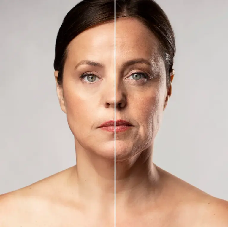 Lifting du visage à Paris : à quel âge et pour quels résultats ?